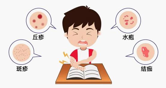 水痘是由水痘-带状疱疹病毒感染引起的一种急性呼吸道传染病.