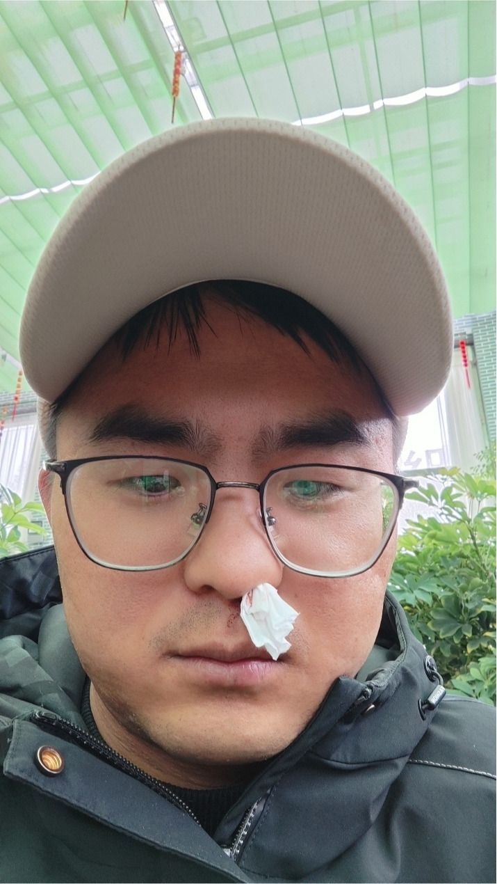 来到阿里,很多人难免会有高原反应,首先是流鼻血,接着还会感到头疼