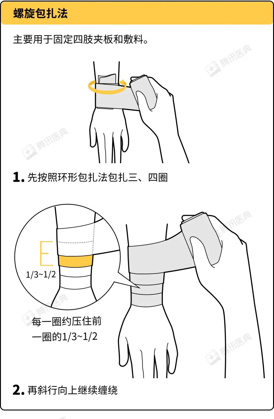 外伤处理中超实用的5种绷带包扎法