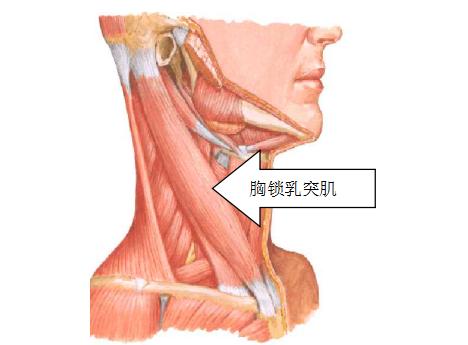 生理性斜颈图片