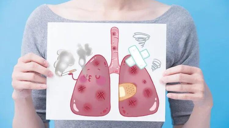 肺癌来临总是“不声不响”，身体有这4个表现，尽早检查