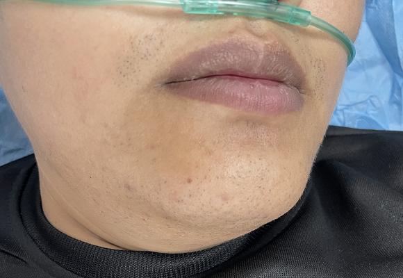 有人吃了咸菜变"紫"了!小心这个"健康刺客"