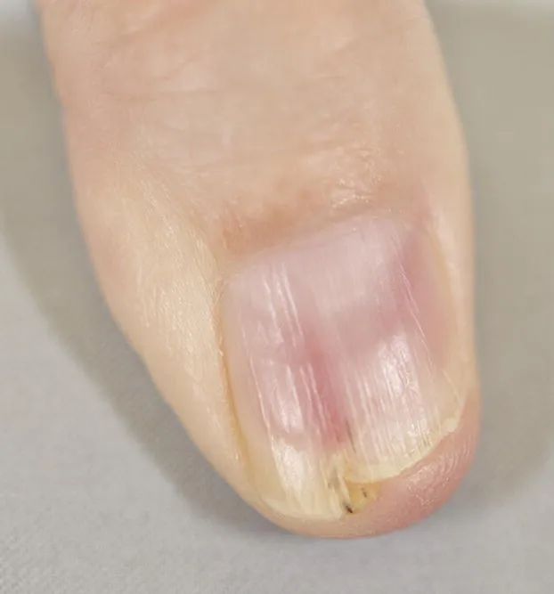 红黄蓝绿黑白,这些五颜六色的指甲是怎么了?