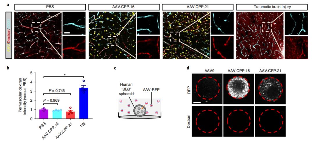 突破血脑屏障,新型aav变体助力脑肿瘤和中枢神经系统遗传疾病的治疗