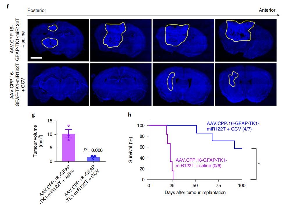 突破血脑屏障,新型aav变体助力脑肿瘤和中枢神经系统遗传疾病的治疗