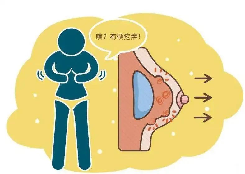 乳腺癌淋巴结肿大图片