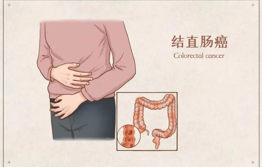 胃肠镜都有什么品牌【小南话科普】90%的疾病都集中在消化道！胃肠镜检查能“救命”！_https://www.jmylbn.com_新闻资讯_第10张