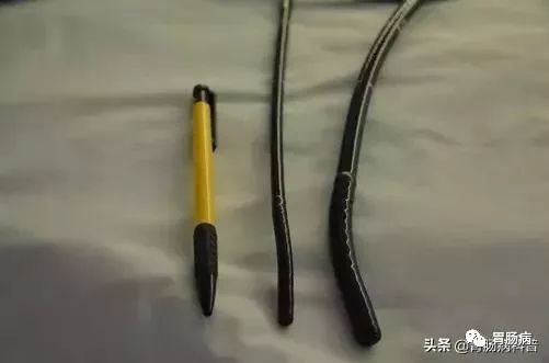 为什么活检钳不是一次性胃镜是一次性的吗？胃肠镜能不能同时做？_https://www.jmylbn.com_新闻资讯_第6张