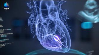 原来心脏内部有一套精密的电路系统——《打开一颗心》