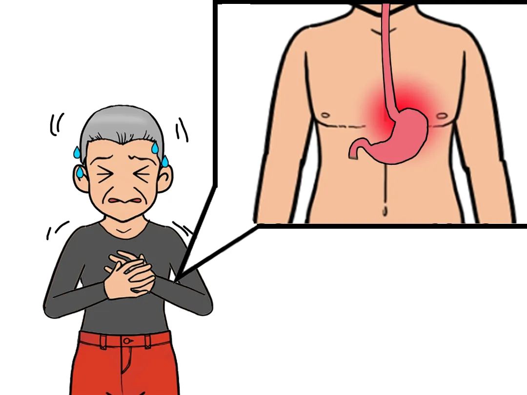 【科普工作委员会】烧心,反酸--得了反流性食管炎怎么办?