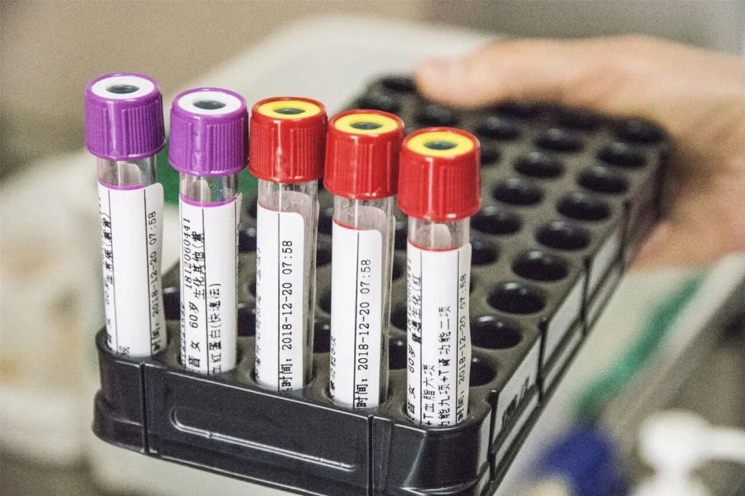 血钾是心衰病人的"预警信号",可惜八成患者都不了解_澎湃号·湃客