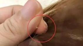 用手扣頭皮，指甲里的“白泥”是啥？