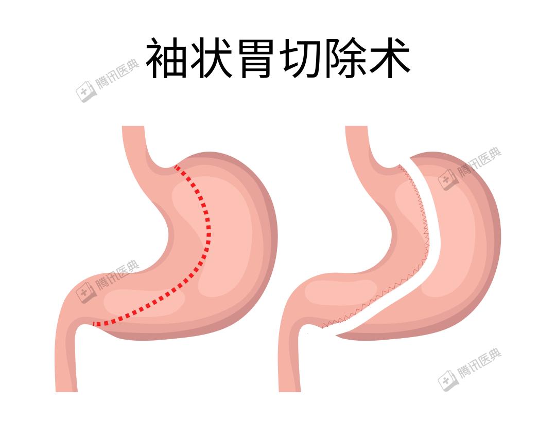 一、胃的形态和分部-基础医学-医学