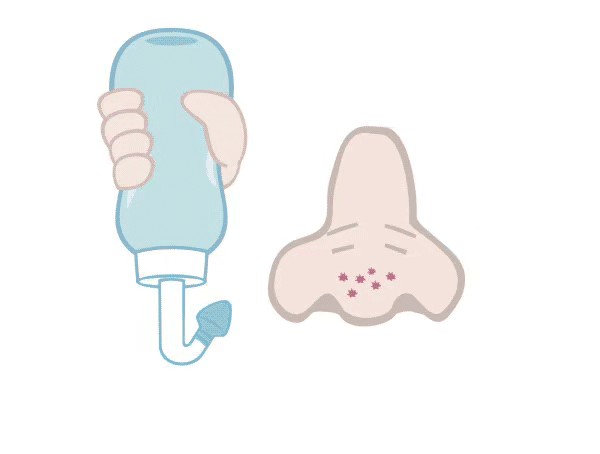 洗鼻子,真的可以预防新冠,缓解症状吗?