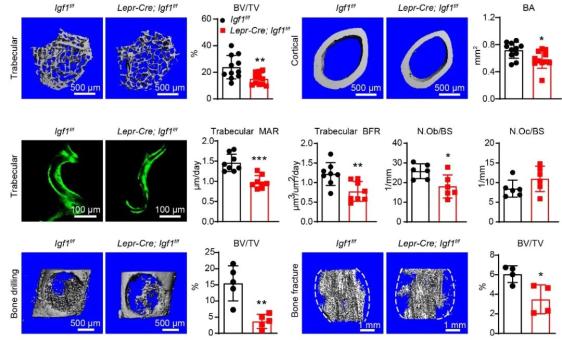 【学术前沿】PNAS | 岳锐课题组揭示骨髓来源IGF-1调控成体骨骼维持与损伤修复_澎湃号·政务_澎湃新闻-The Paper