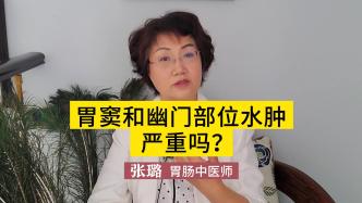 胃窦和幽门部位水肿严重吗？别不当回事，及早治疗才是重中之重