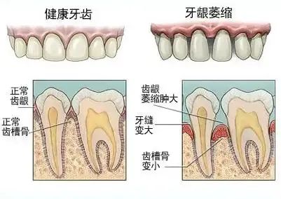 【科普面对面】不同年龄段有不同的口腔保健法