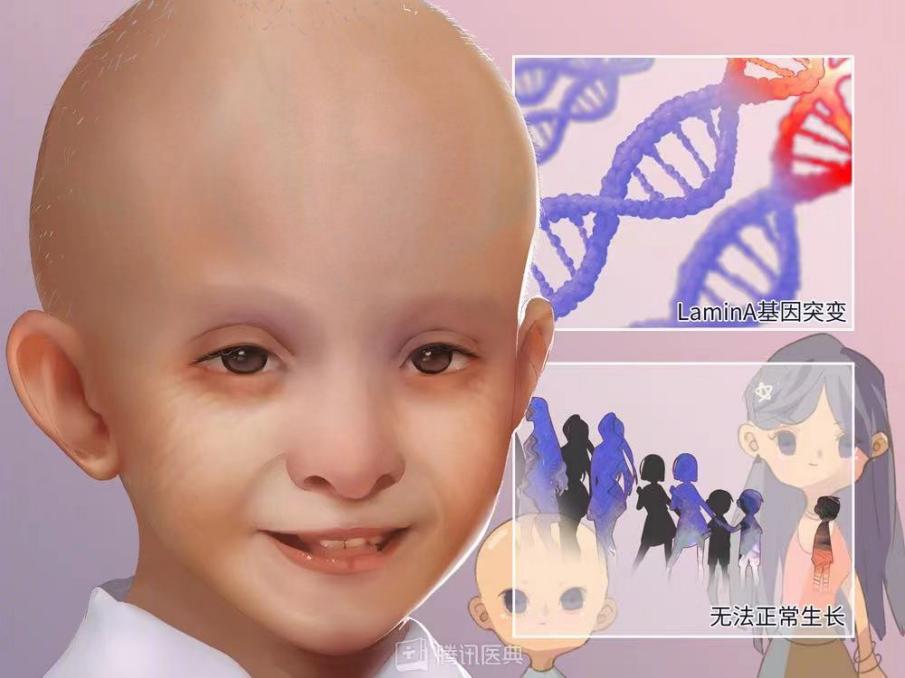 “吸血鬼症”“身体像定时炸弹”，这些患者的呼救需要被听见