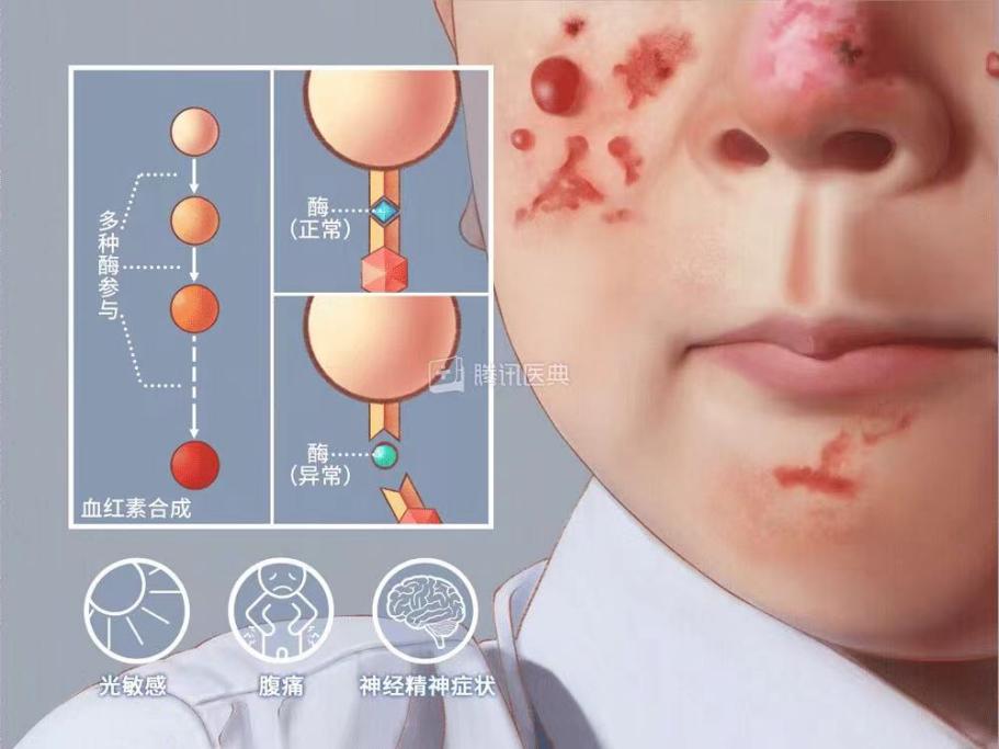 “吸血鬼症”“身体像定时炸弹”，这些患者的呼救需要被听见