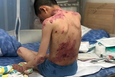 “吸血鬼症”“身体像定时炸弹”，这些患者的呼救需要被听见