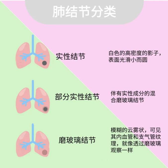 女子查出肺结节不重视成肺癌晚期能治好吗，肺结节不重视恶化至晚期，能否治愈？,肺结节,肺癌晚期,女子查出肺结节不重视成肺癌晚期,第1张