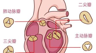 体检发现的心脏瓣膜反流是什么？要紧吗？