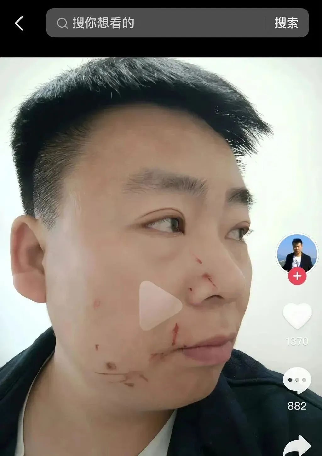 女明星合成 男网红称因合成女明星视频被打，网友：这算不算隔空性骚扰？