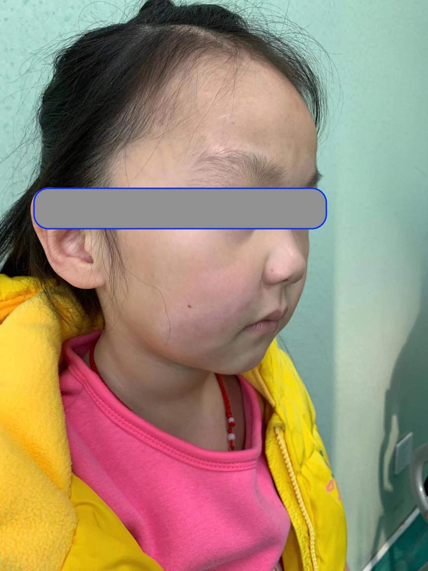 手术缝合针线怎么消毒急，宝宝的脸摔出好大口子，哪里能缝美容针？_https://www.jmylbn.com_新闻资讯_第6张