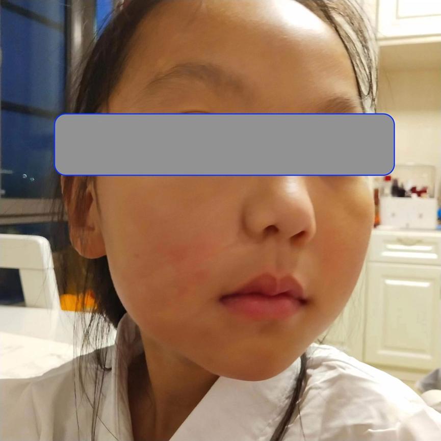 手术缝合针线怎么消毒急，宝宝的脸摔出好大口子，哪里能缝美容针？_https://www.jmylbn.com_新闻资讯_第7张