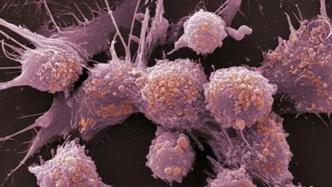 如何击碎癌细胞的再生梦？