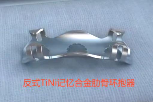 肋骨怎么记忆沪上首例！区中西医结合医院成功实施一例全胸腔镜下肋骨骨折内固定手术（反式TiNi记忆合金环抱式接骨…_https://www.jmylbn.com_新闻资讯_第8张