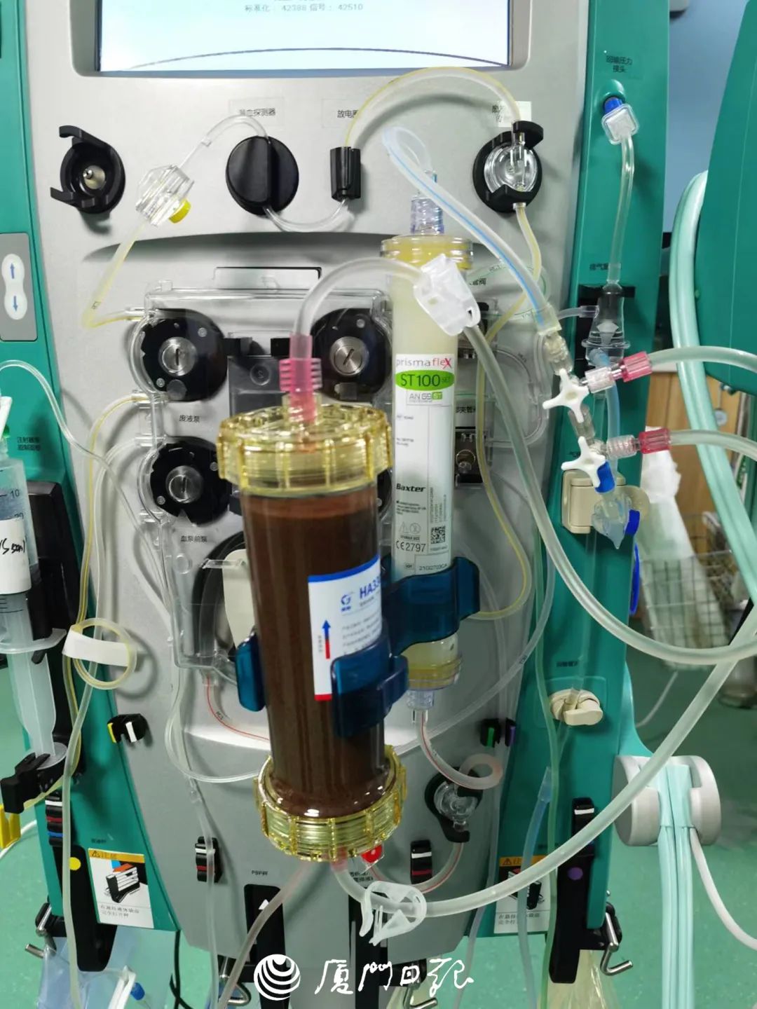 床旁连续性血液滤过(crrt) 血液灌流治疗.