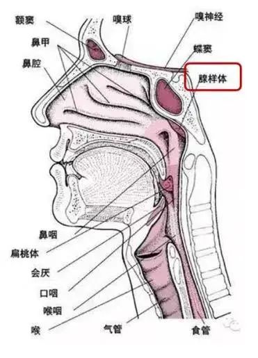 咽侧索肥厚图片