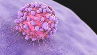 精力充沛的T细胞将提高癌症免疫疗法的有效性