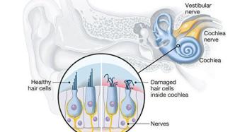 失去的听力还能恢复？研究提供新途径