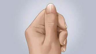 指甲若出现4种异常，可能是癌或疾病的信号