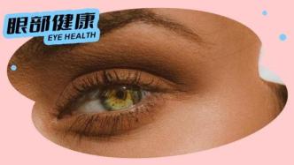 偏爱女性的5种眼部疾病，做好这些就能预防