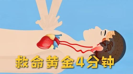肺复苏的主要措施是_14岁女生心脏骤停_肺复苏应该在什么地方进行