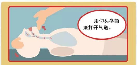 14岁女生心脏骤停_肺复苏的主要措施是_肺复苏应该在什么地方进行