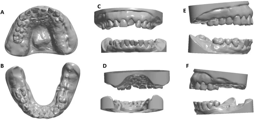 放射科器械怎么打包数字化定制口腔器械，优化头颈部癌症放疗效果 ｜ Cell Press论文速递_https://www.jmylbn.com_新闻资讯_第3张