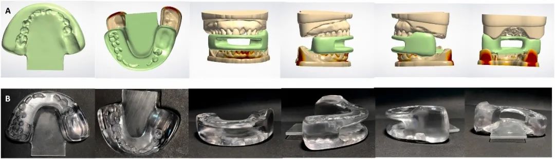 放射科器械怎么打包数字化定制口腔器械，优化头颈部癌症放疗效果 ｜ Cell Press论文速递_https://www.jmylbn.com_新闻资讯_第4张