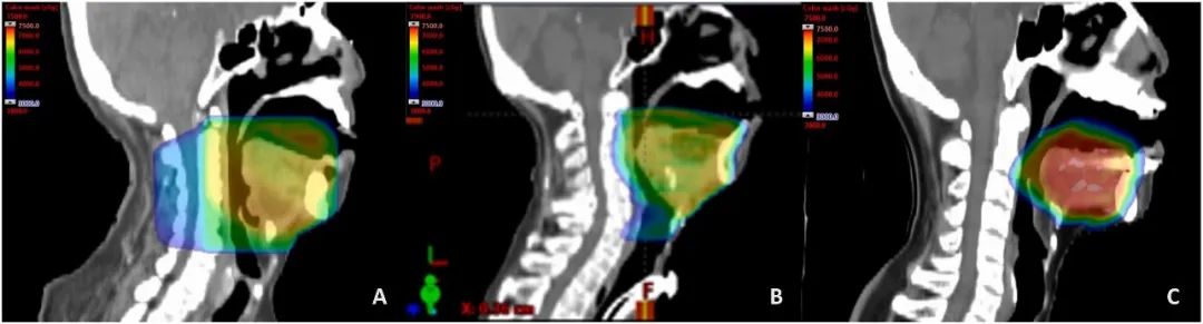 放射科器械怎么打包数字化定制口腔器械，优化头颈部癌症放疗效果 ｜ Cell Press论文速递_https://www.jmylbn.com_新闻资讯_第5张
