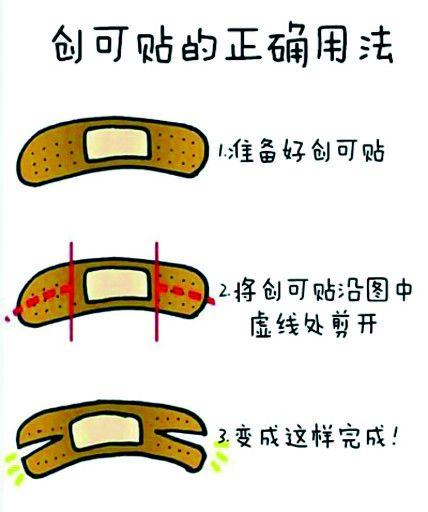 无纺伤口垫怎么用公卫·科普｜创可贴不是处理伤口的“万金油”_https://www.jmylbn.com_新闻资讯_第1张