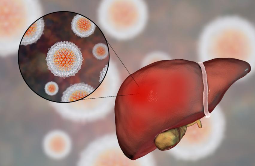 目前,已知的常见肝炎类型包括甲肝,乙肝,丙肝,丁肝和戊肝等,都是国家