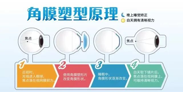 注意OK镜使用 我市开展专项治理