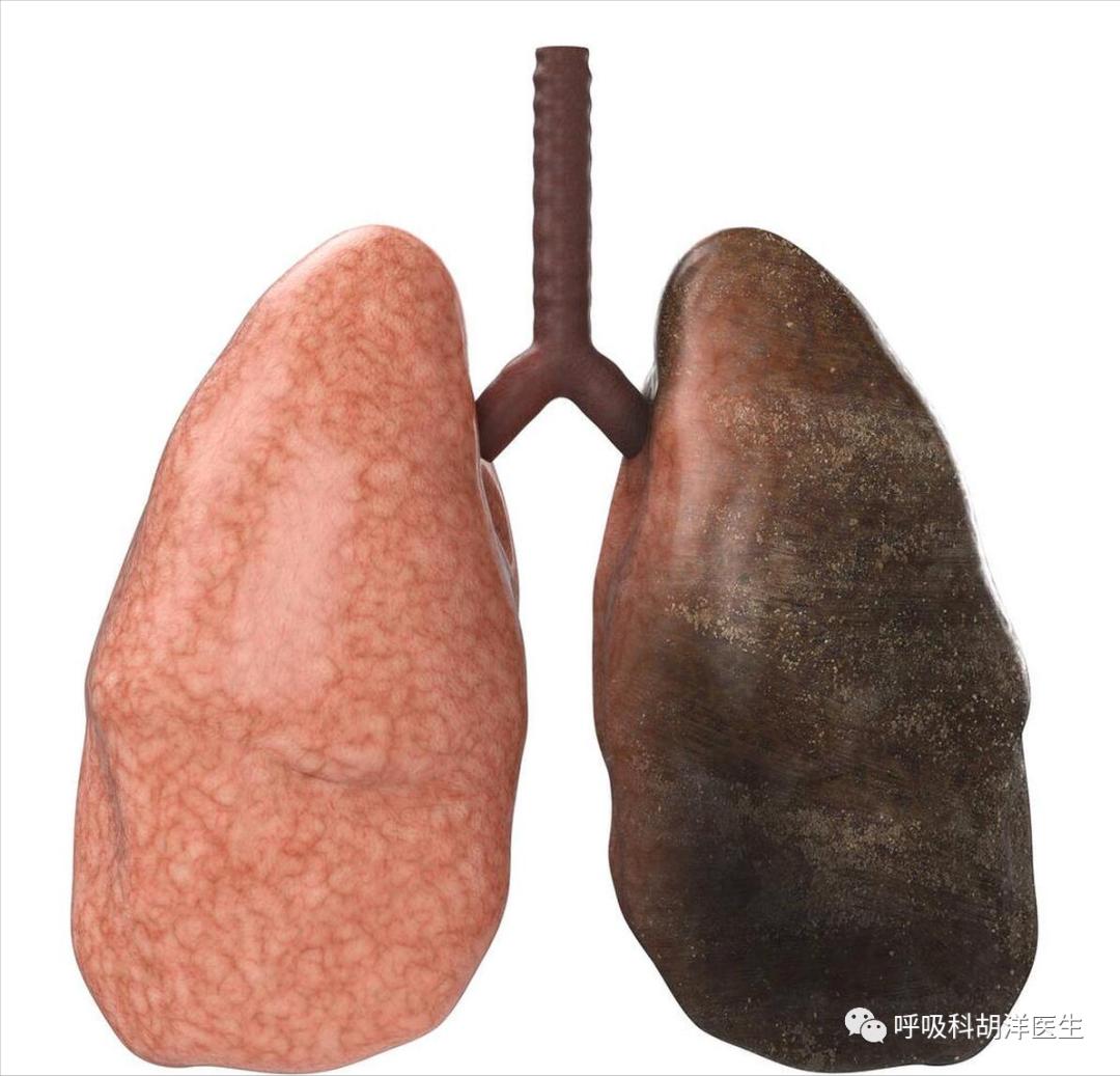 抽烟多久肺会变黑？ - 知乎