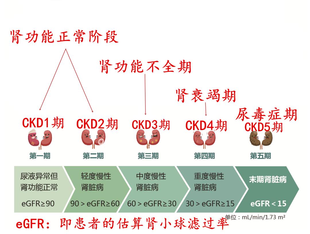 ckd1期,肾小球滤过率≥90ml/min/1