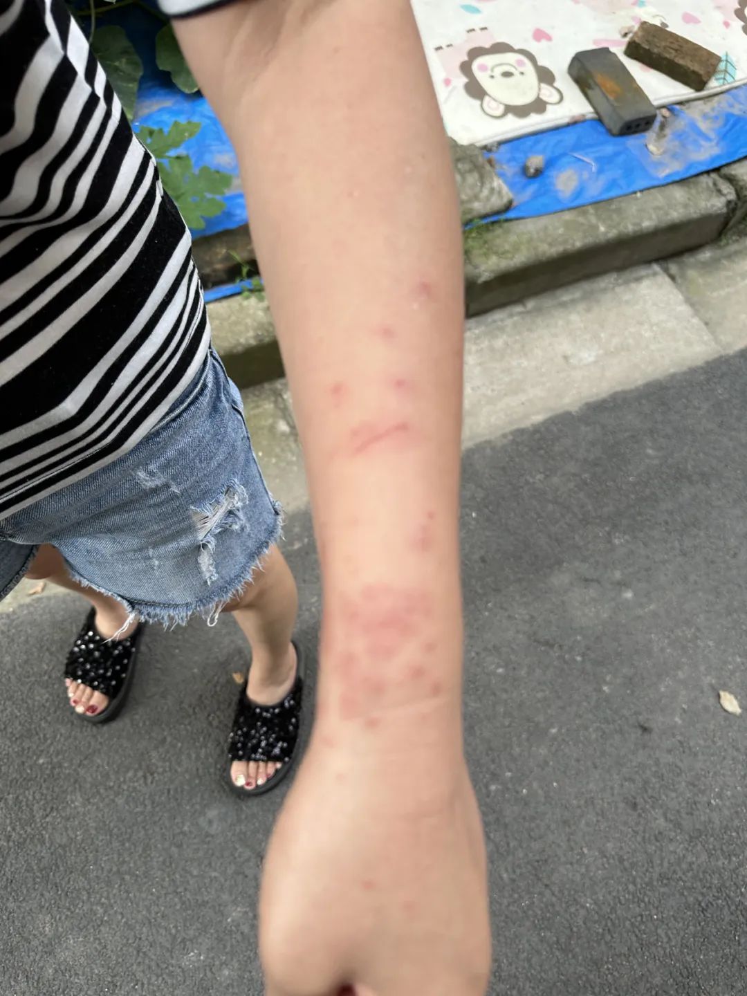 某地2个居民小区突发聚集性皮疹,"罪魁祸首"竟是这种毛毛虫!