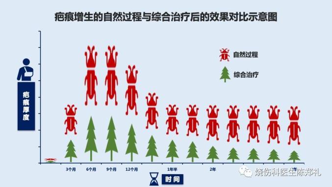 凝胶敷贴能贴多久经典回顾 ｜ 疤痕综合治疗方案-AED除颤器产品网