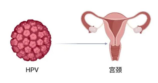 查出hpv阳性，离宫颈癌还有多远？